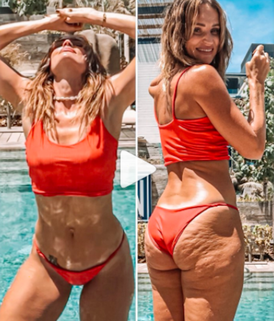 Come Nascondere La Cellulite In Foto Il Trucco Di Danae Mercer