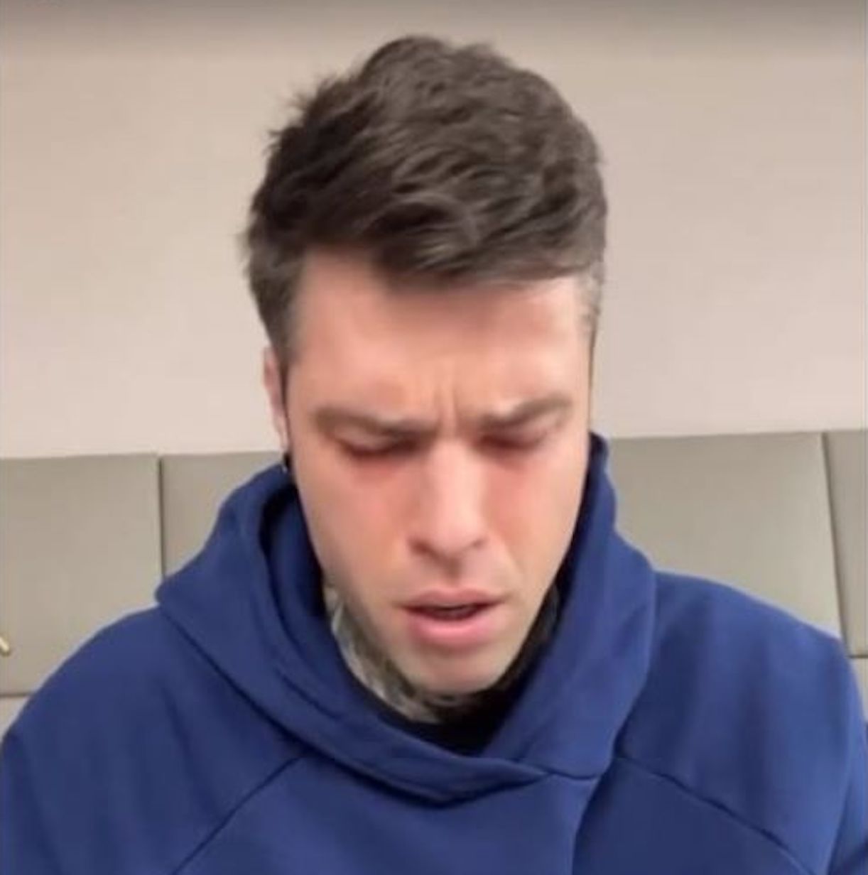 fedez affetto sclerosi multipla ipotesi