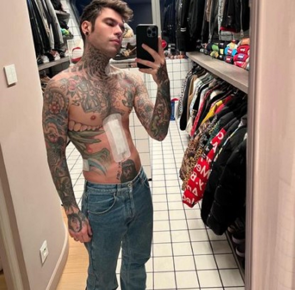 Fedez foto cicatrice messaggio coraggio