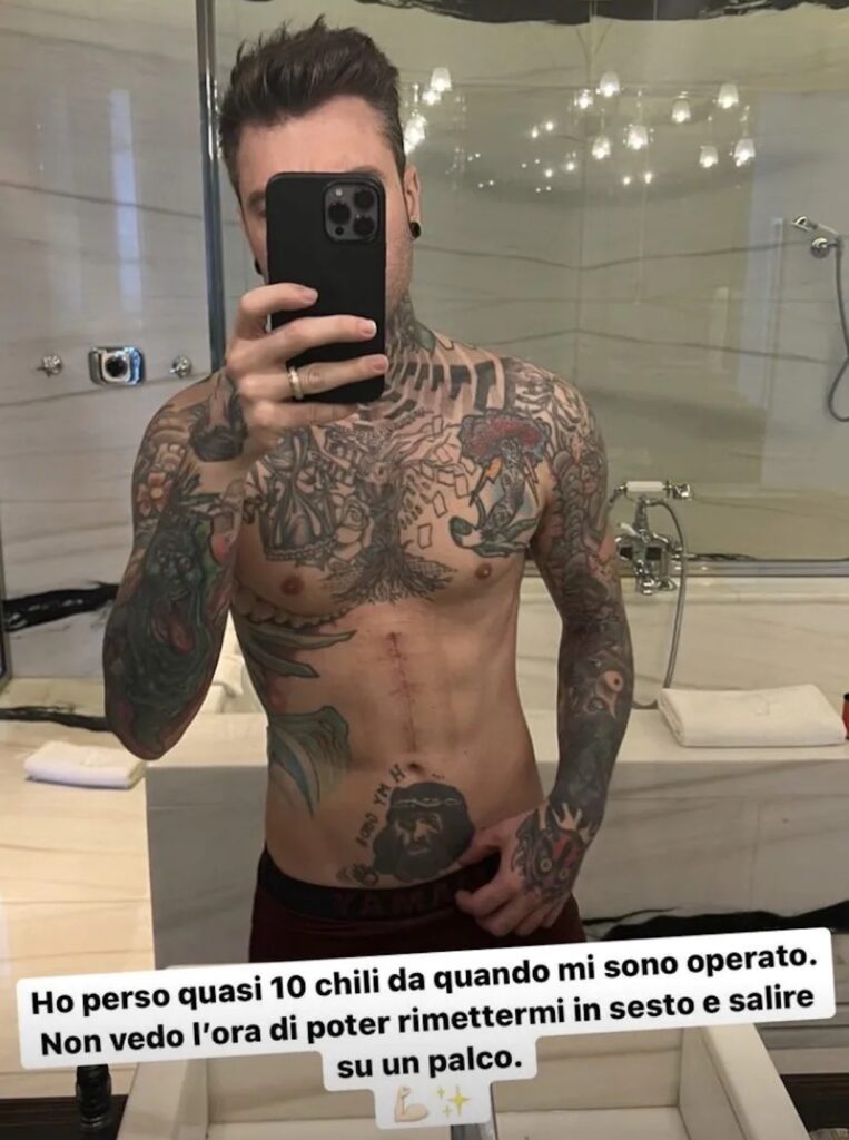 fedez dimagrito 10 kg operazione