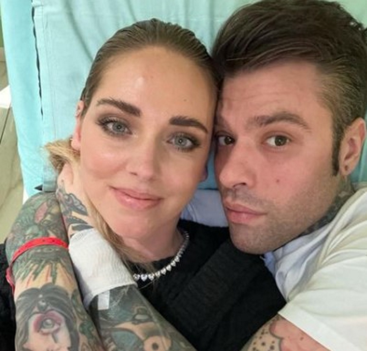 Fedez foto cicatrice messaggio coraggio