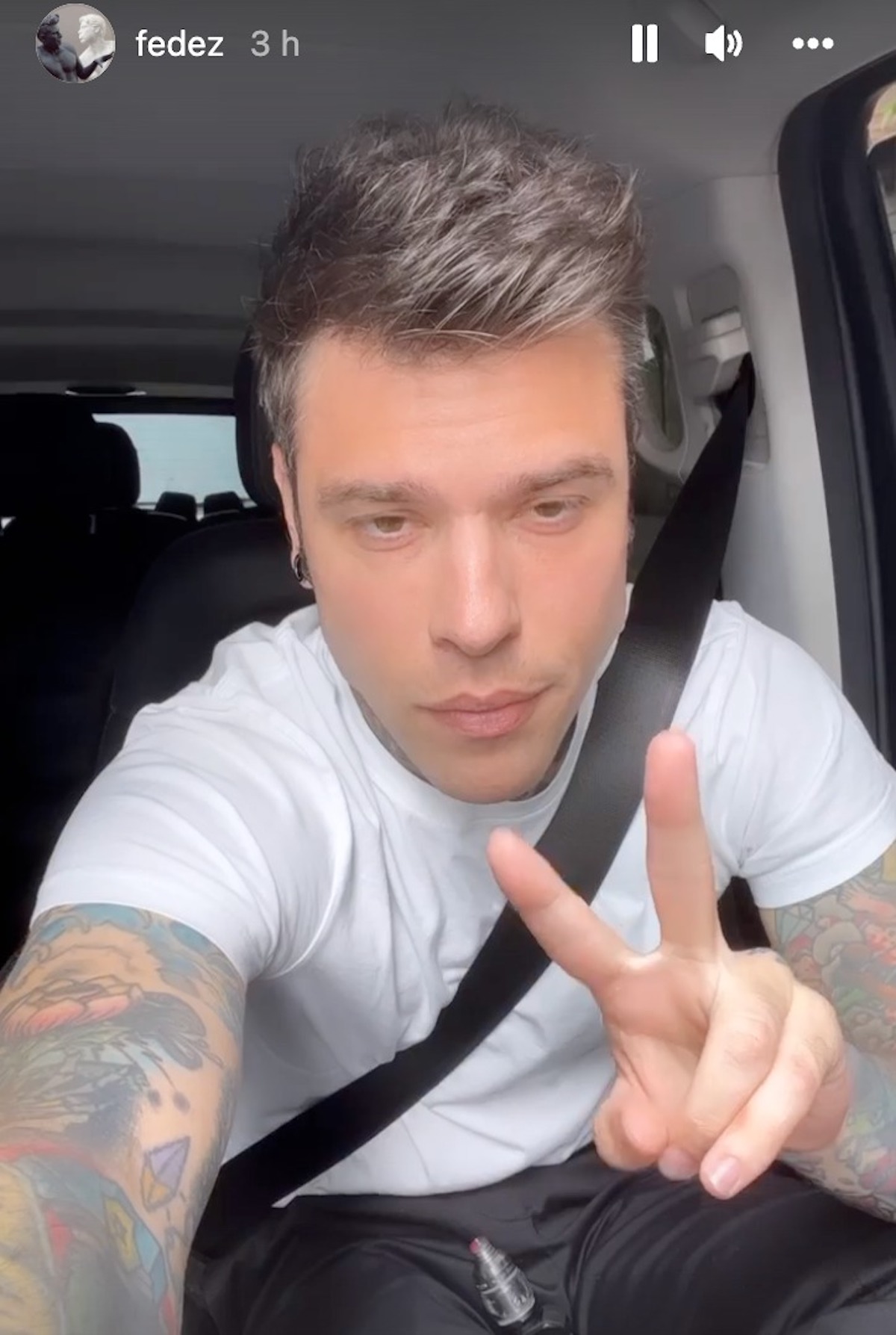 Fedez tumore esame istologico linfonodi