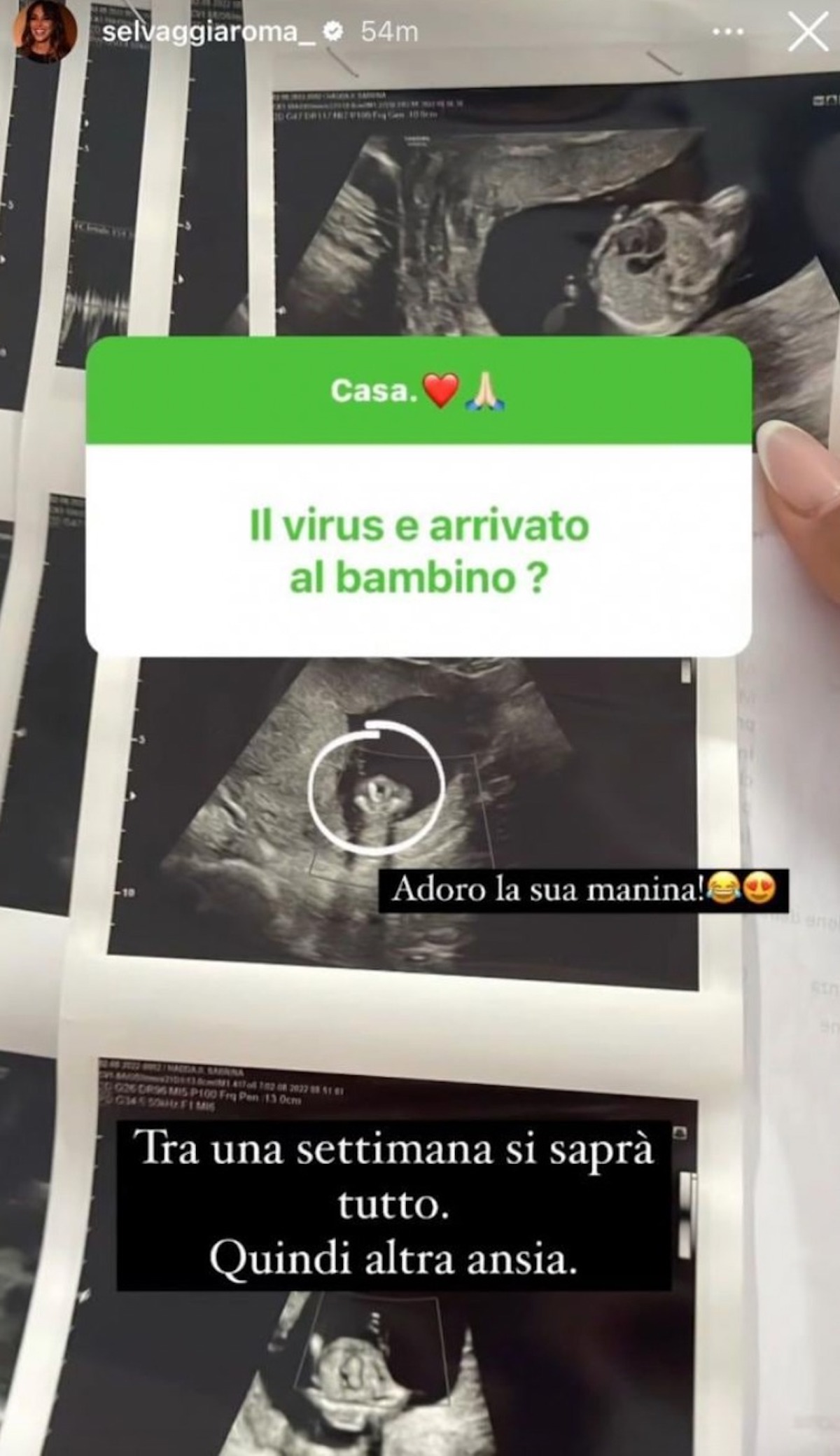 selvaggia roma incinta citomegalovirus amniocentesi