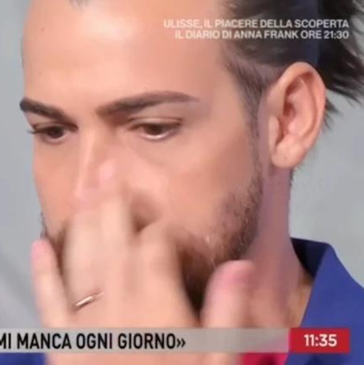 Valerio Scanu, confessione choc: “Un tumore: asportato polmone”