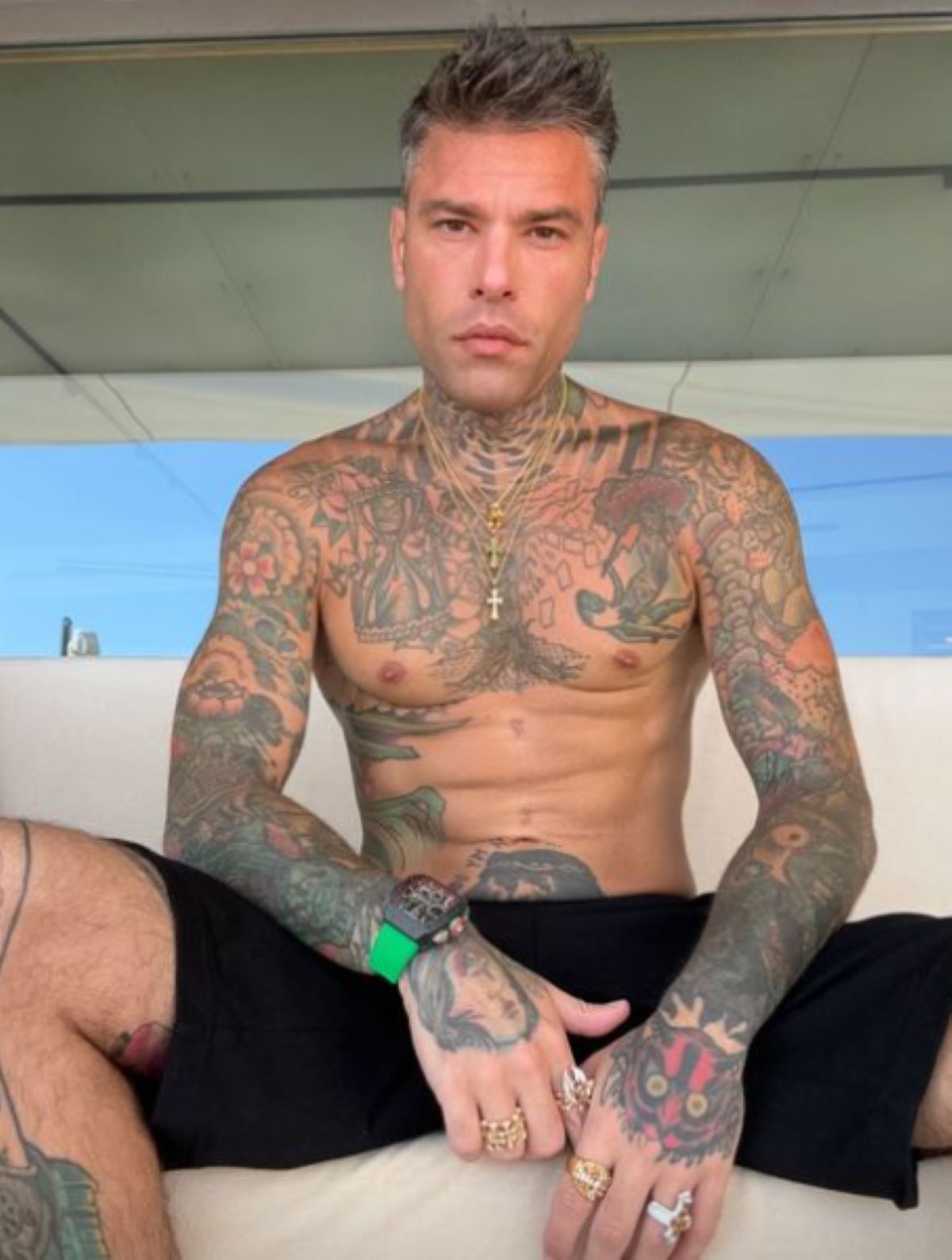 Fedez Ricovero