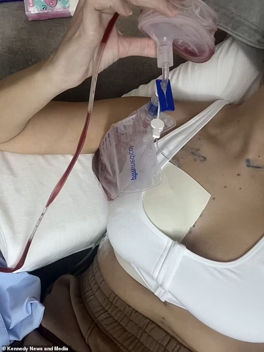 Sintomi e diagnosi del medico sbagliata, Courtney Bailey scopre di avere un tumore al seno