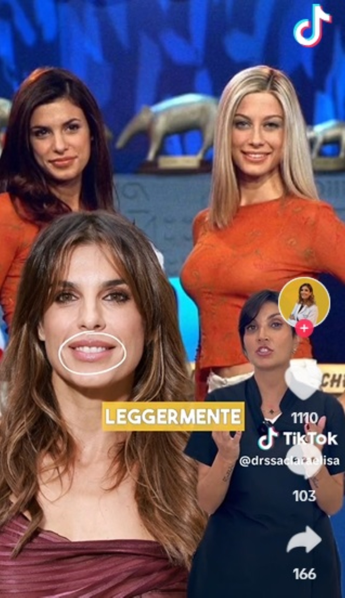 elisabetta canalis cosa si è rifatta