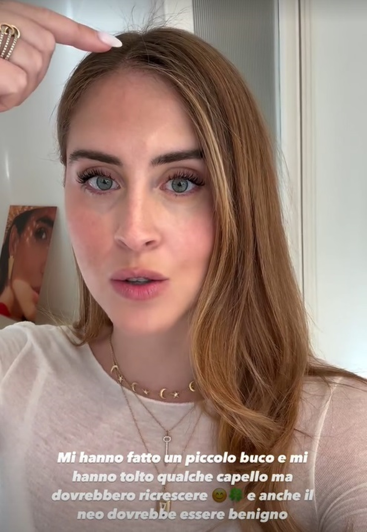 valentina ferragni intervento come sta